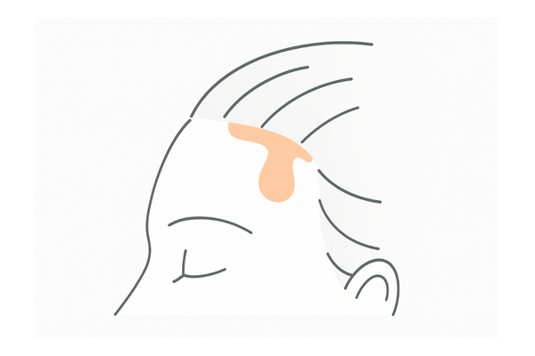 ジェル／クリームタイプ育毛剤が生え際にとどまる密着イメージ（液だれしにくい）