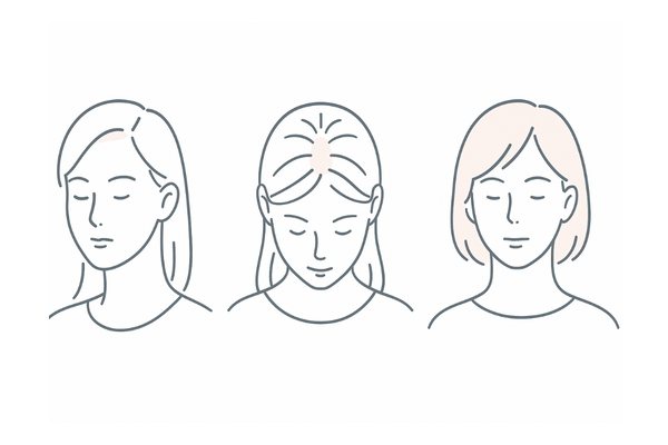 女性の薄毛タイプ別の特徴イメージ(生え際・分け目・びまん性の比較)