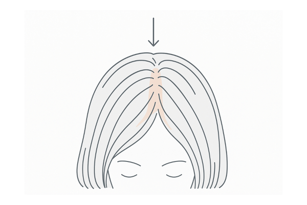 分け目やつむじ部分の地肌が目立つ理由のイメージ