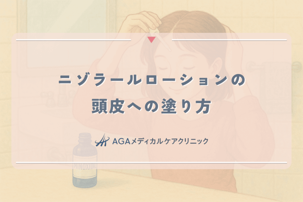 ニゾラールローションの頭皮への正しい塗り方｜脂漏性皮膚炎のケア