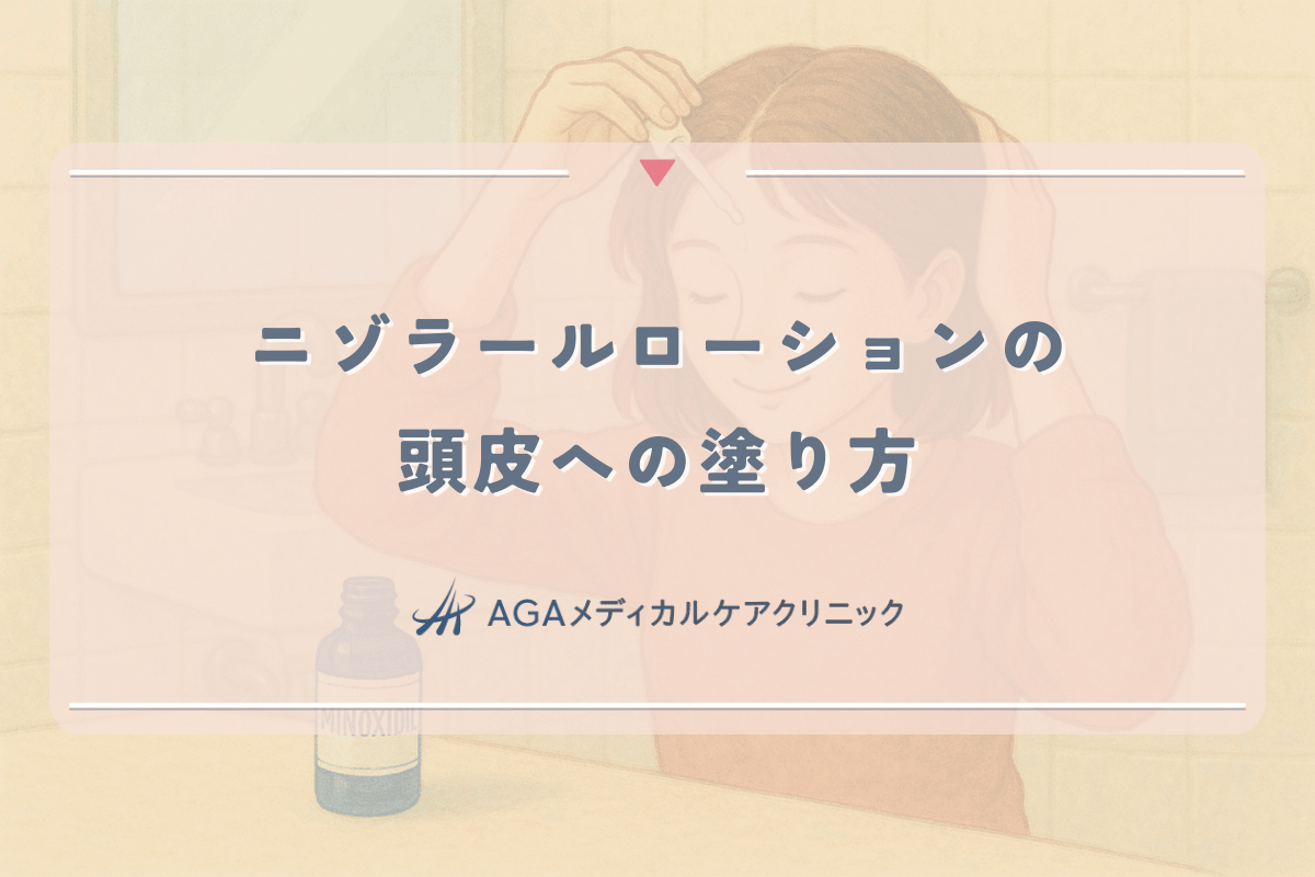 ニゾラールローションの頭皮への正しい塗り方|脂漏性皮膚炎のケア
