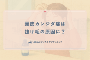 頭皮カンジダ症は抜け毛の原因に？女性が知るべき症状と皮膚科での治療法