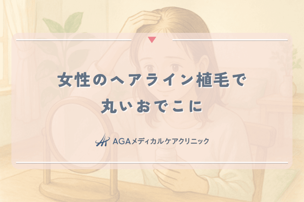 女性のヘアライン植毛で丸いおでこに。費用とバレない自然な仕上がり