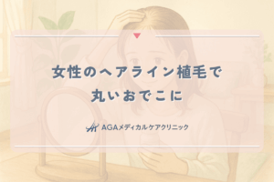 女性のヘアライン植毛で丸いおでこに。費用とバレない自然な仕上がり