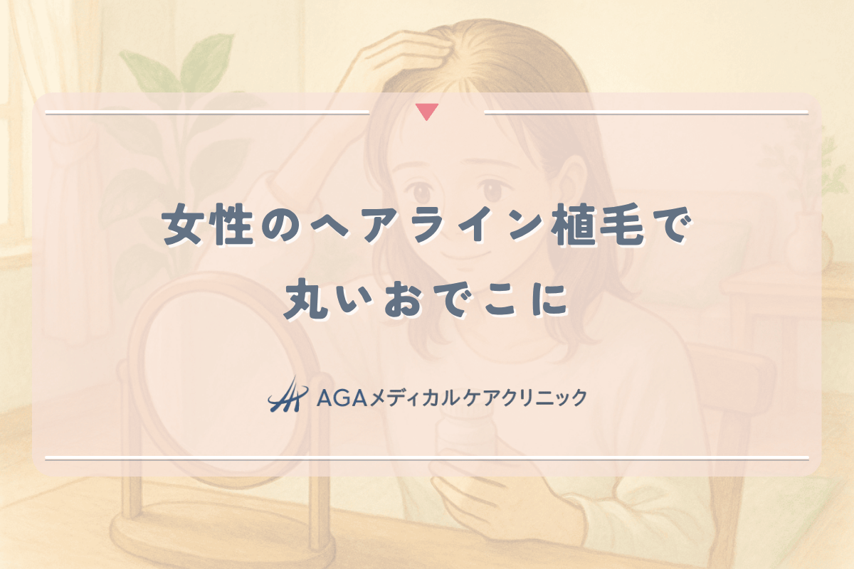 女性のヘアライン植毛で丸いおでこに。費用とバレない自然な仕上がり