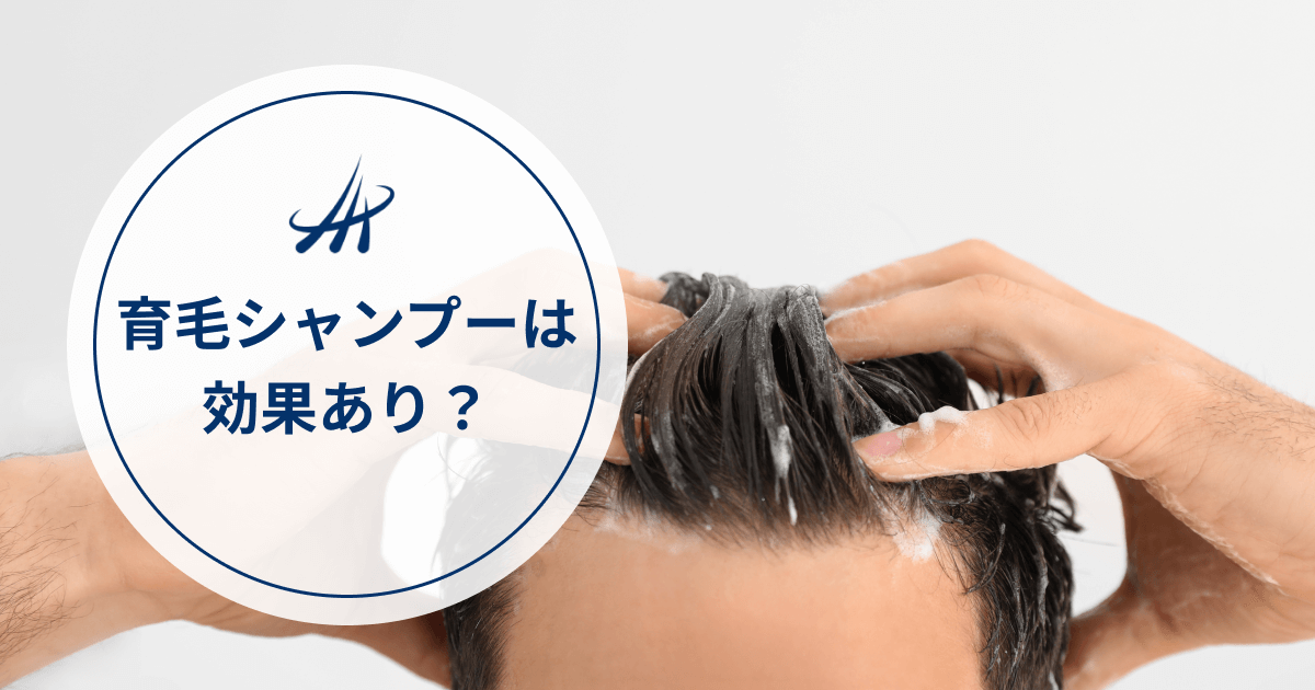 AGA・薄毛予防に育毛シャンプーは効果あり？男女別の選び方を理解して正しい抜け毛対策を