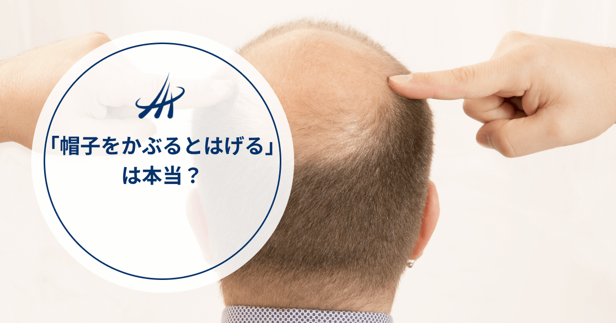 「帽子をかぶるとはげる」は本当か｜帽子が薄毛にもたらす影響と薄毛の予防法を解説