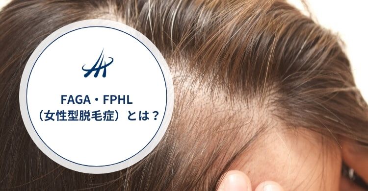 FAGA・FPHL（女性型脱毛症）とは？