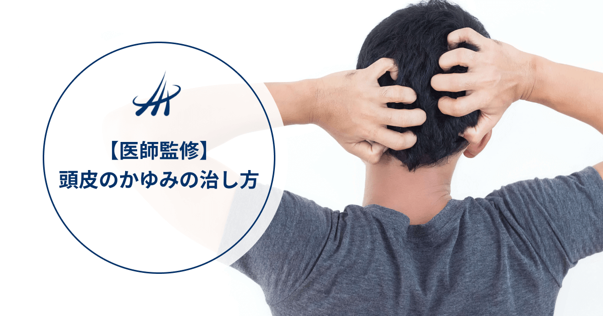 【医師監修】頭皮のかゆみの治し方｜原因別の対策をわかりやすく解説