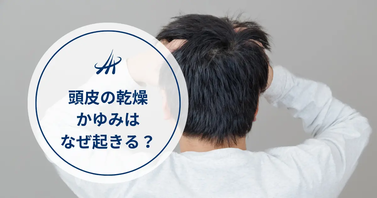 【医師監修】頭皮の乾燥・かゆみはなぜ起きる？原因と正しい対策
