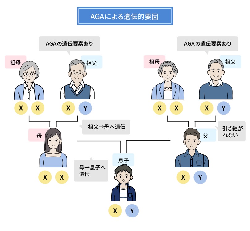 AGAによる遺伝的要素