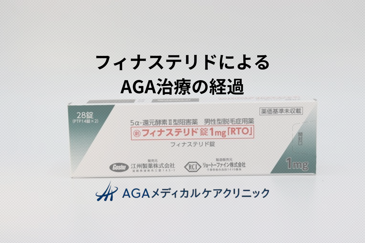 医師が解説！フィナステリドの効果が現れるまでの経過とは