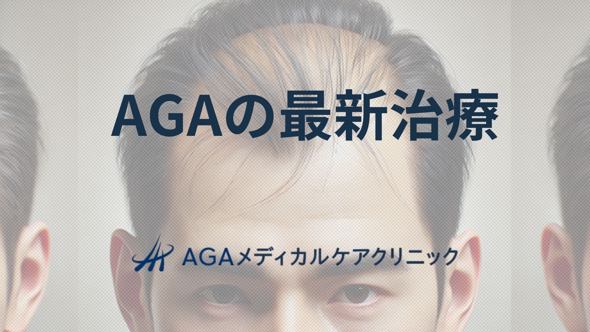 AGA 最新治療を軸に考える男性型脱毛症への取り組み