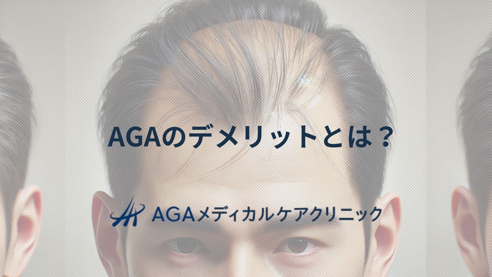 AGAのデメリットと副作用を知る 薄毛に悩む方への治療アプローチ