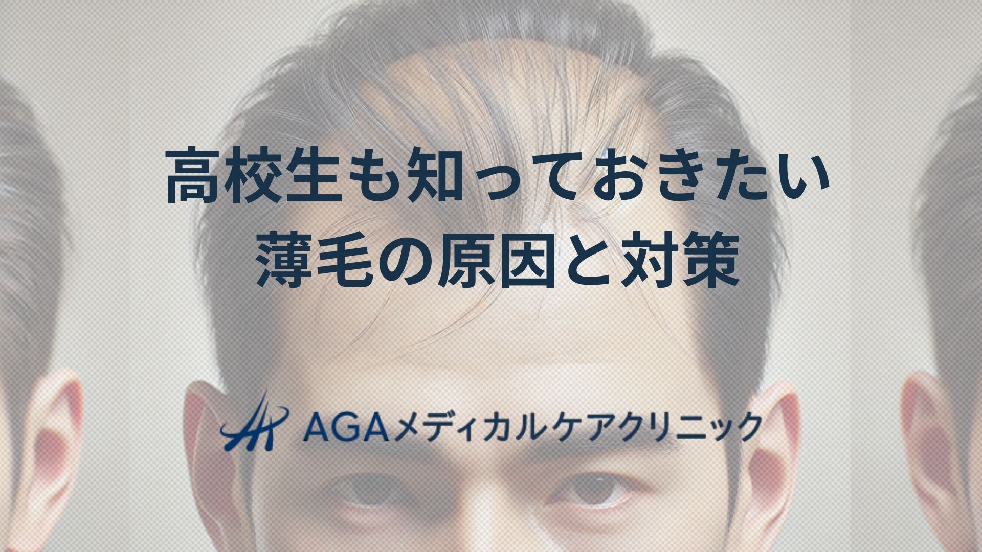 高校生も知っておきたい薄毛の原因と対策