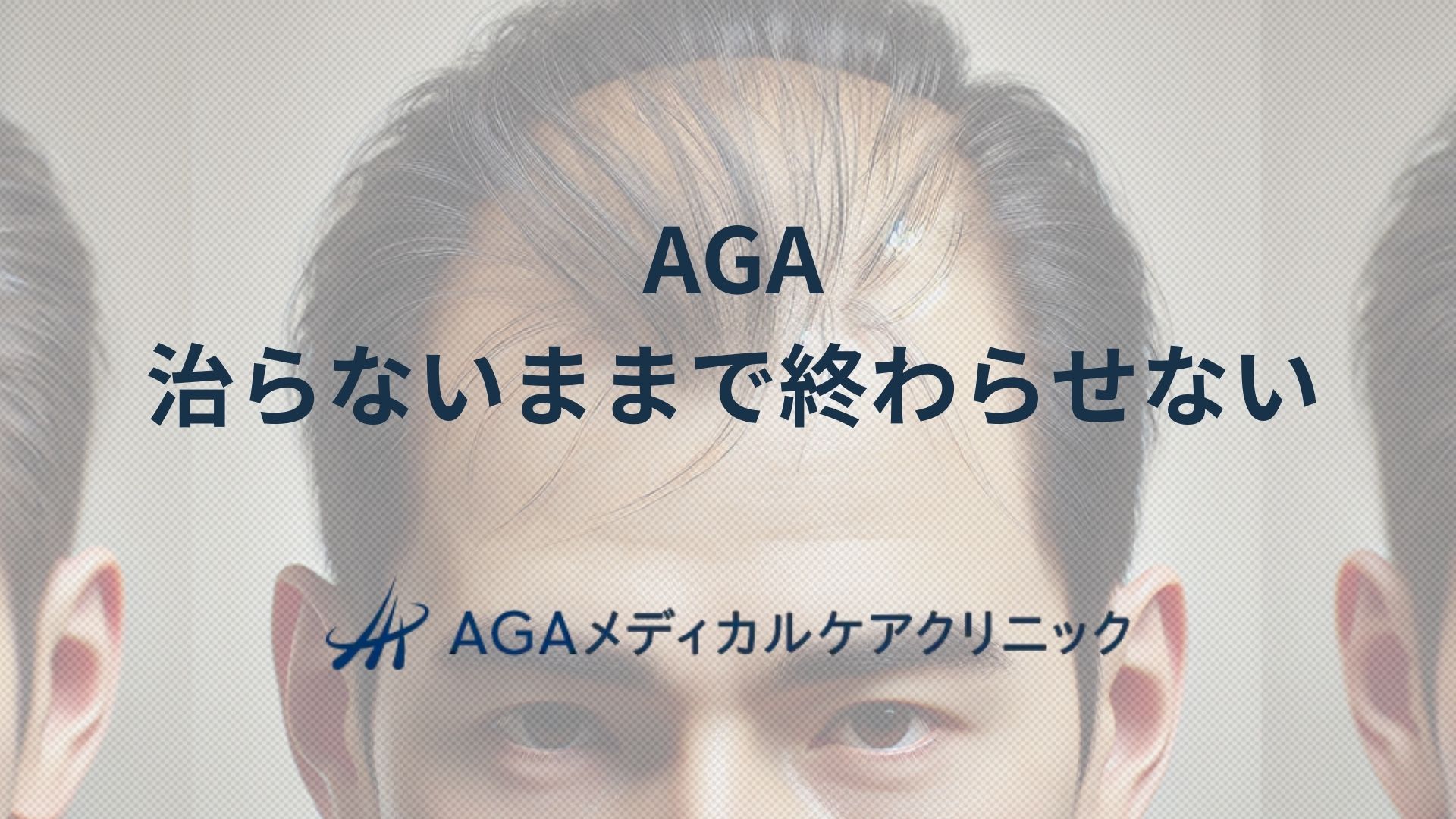 AGA 治らないままで終わらせないための治療と生活習慣の見直し