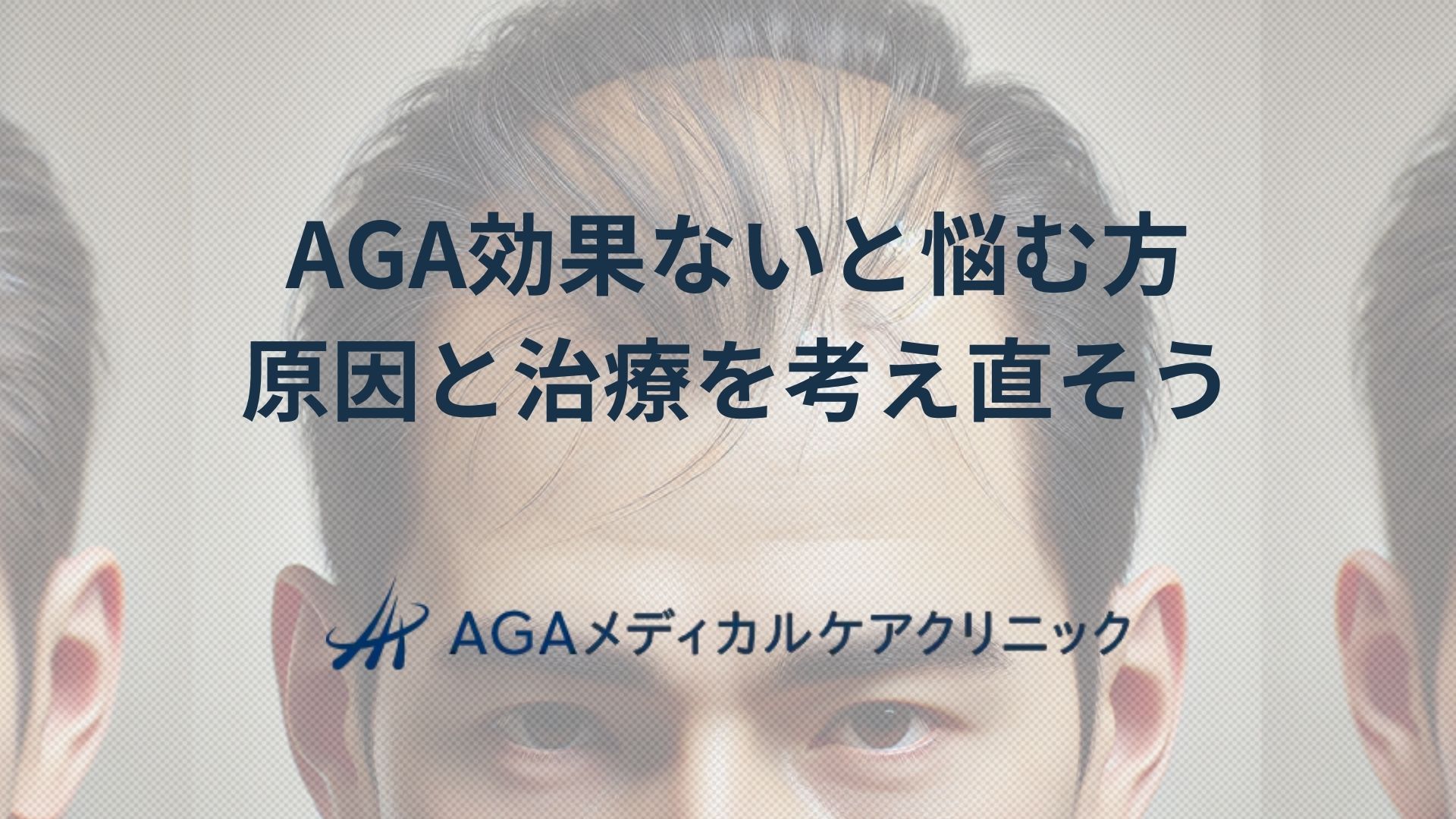 AGA 効果ないと悩む方が再考したい治療の進め方