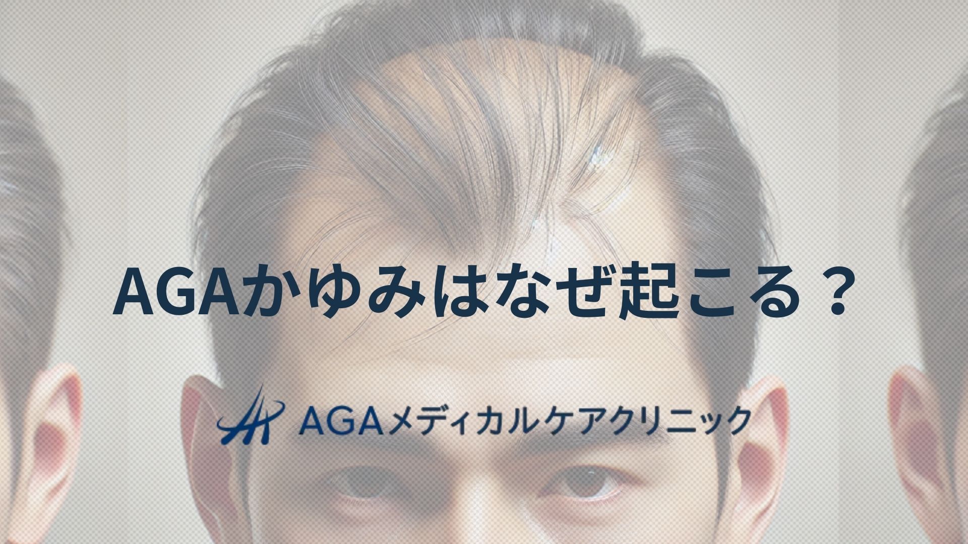 AGAでかゆみはなぜ起こる？頭皮の仕組みと薄毛予防のための知識