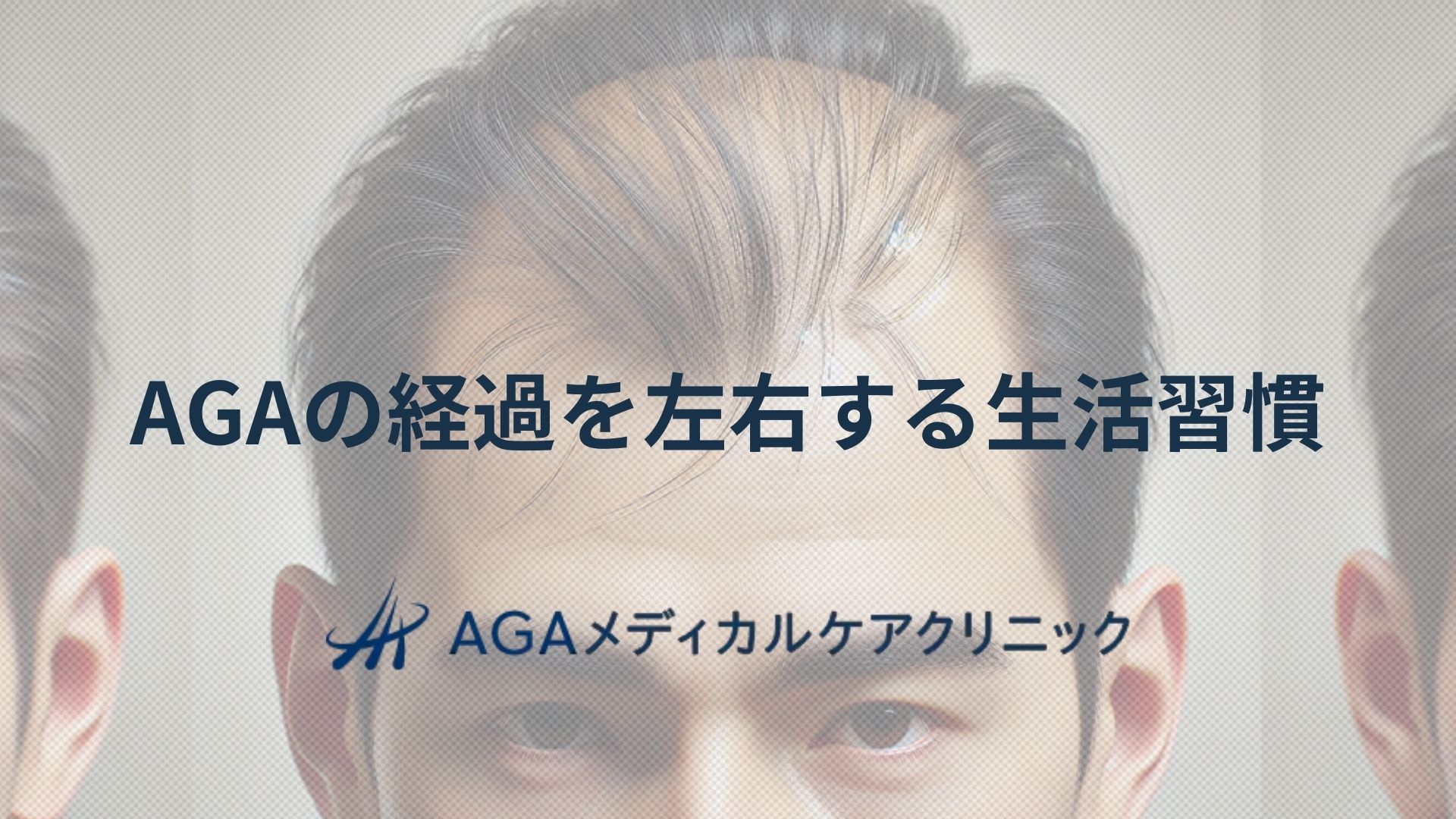AGAの経過を左右する生活習慣:薄毛克服に向けた治療と日常ケアの両立