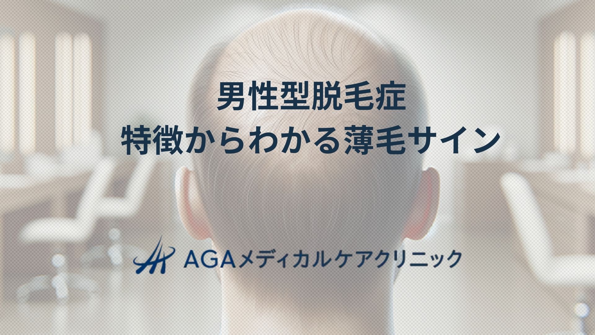 男性型脱毛症特徴が示す薄毛のサイン：治療と日常の注意点