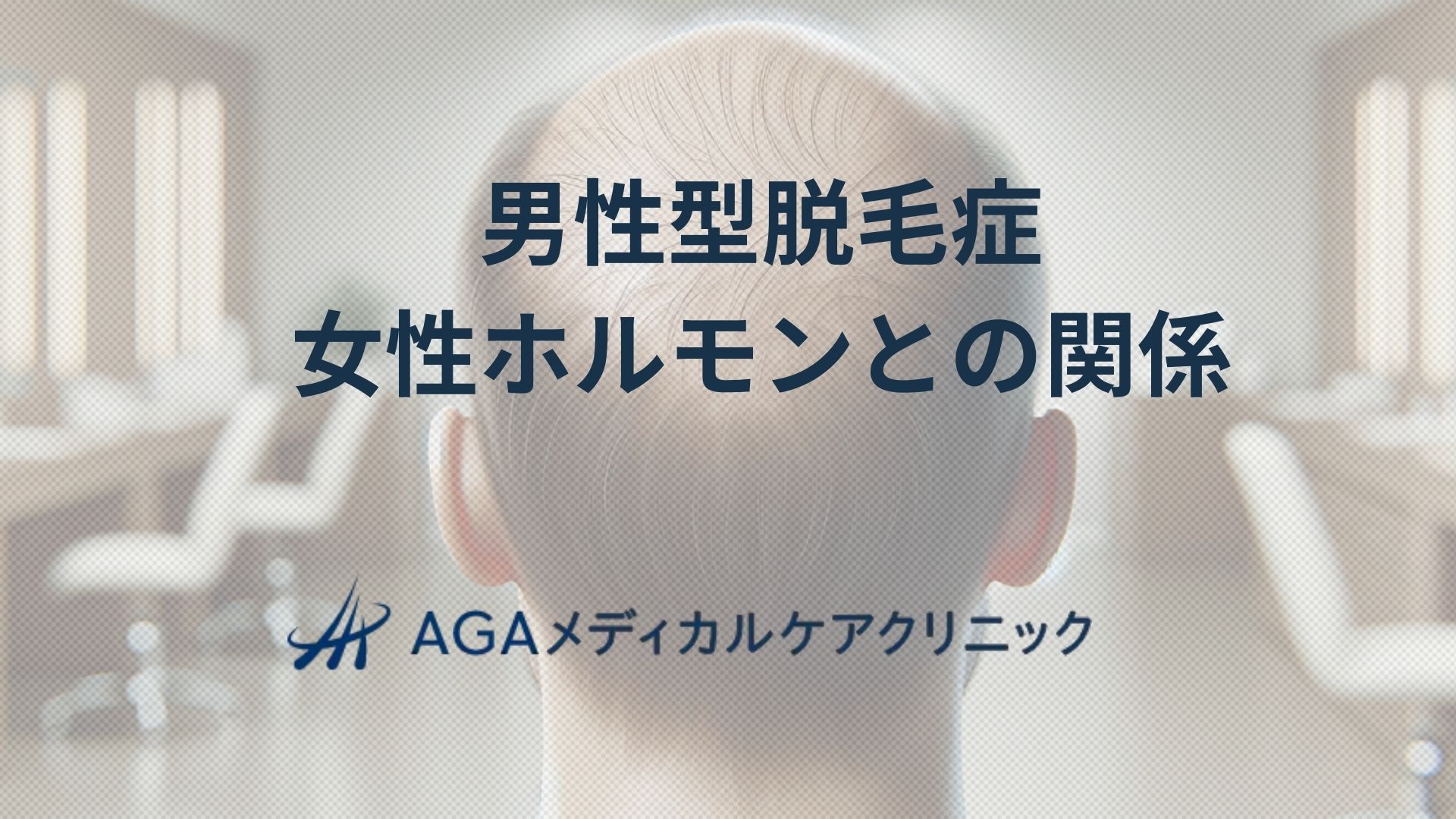 男性型脱毛症 女性ホルモンとの関係 FAGAとの違いと薄毛対策