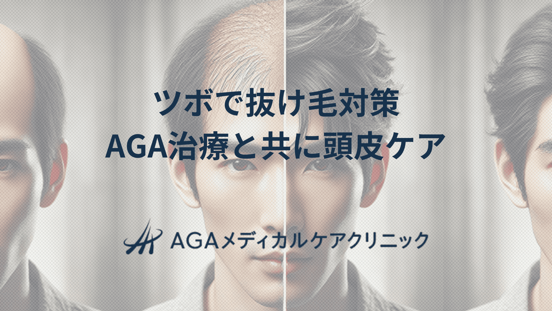 ツボで抜け毛対策　AGA治療とあわせて頭皮ケアを充実