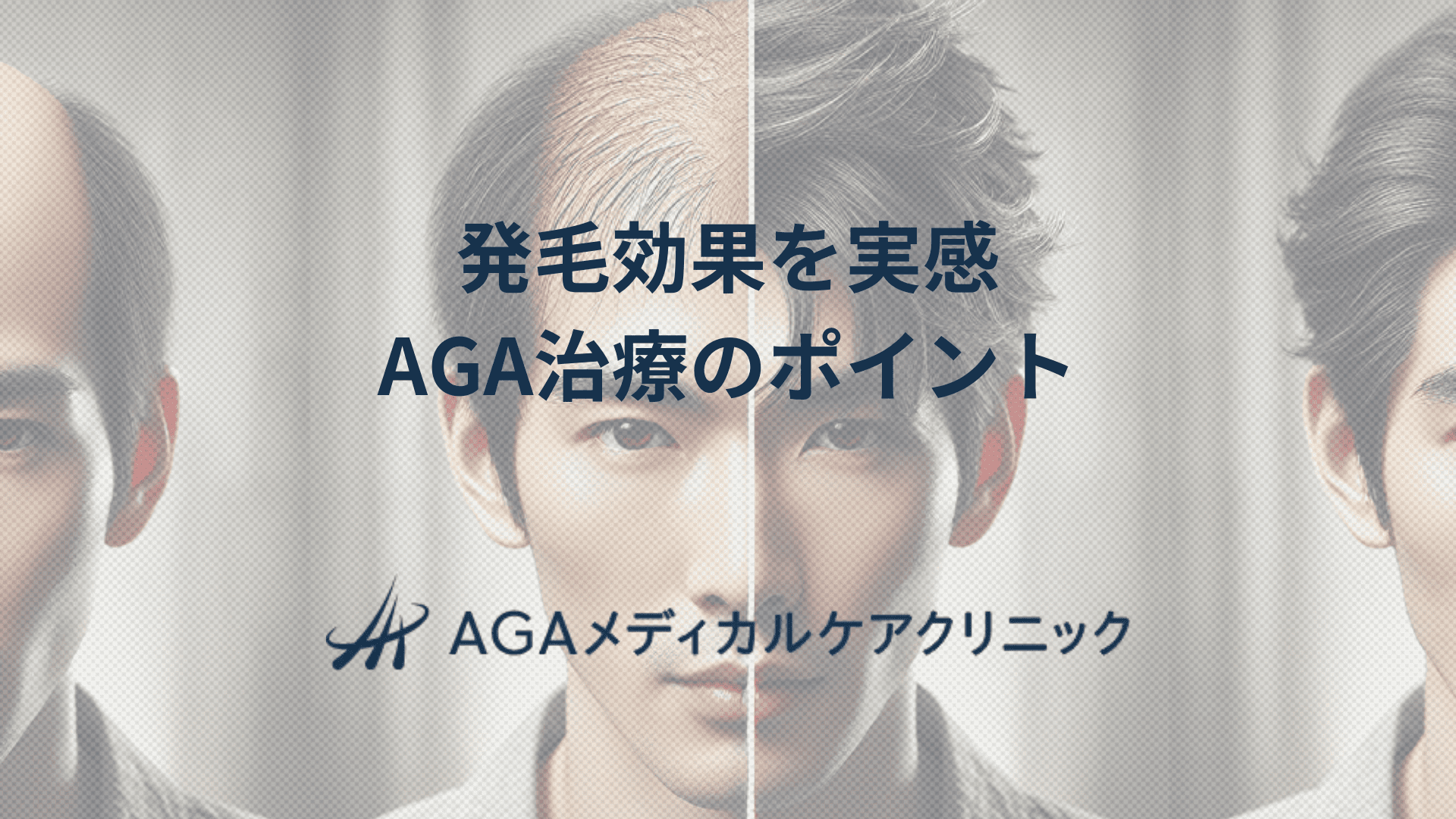 発毛効果を実感したい人へ　AGA治療のポイント