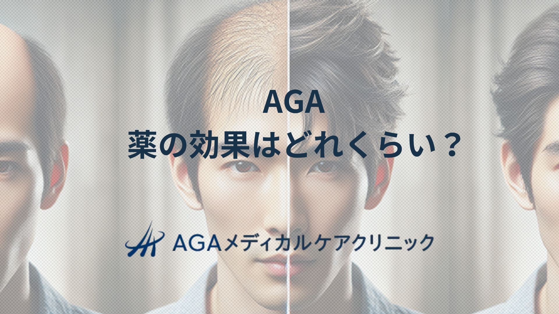 AGA 薬の効果はどれくらい？特徴や治療期間の概要