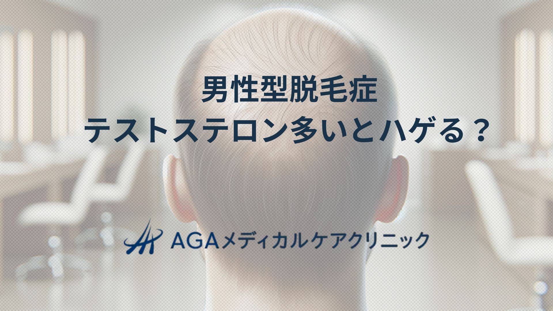 男性型脱毛症テストステロンが多いとハゲる？AGAとDHTの関係に迫る