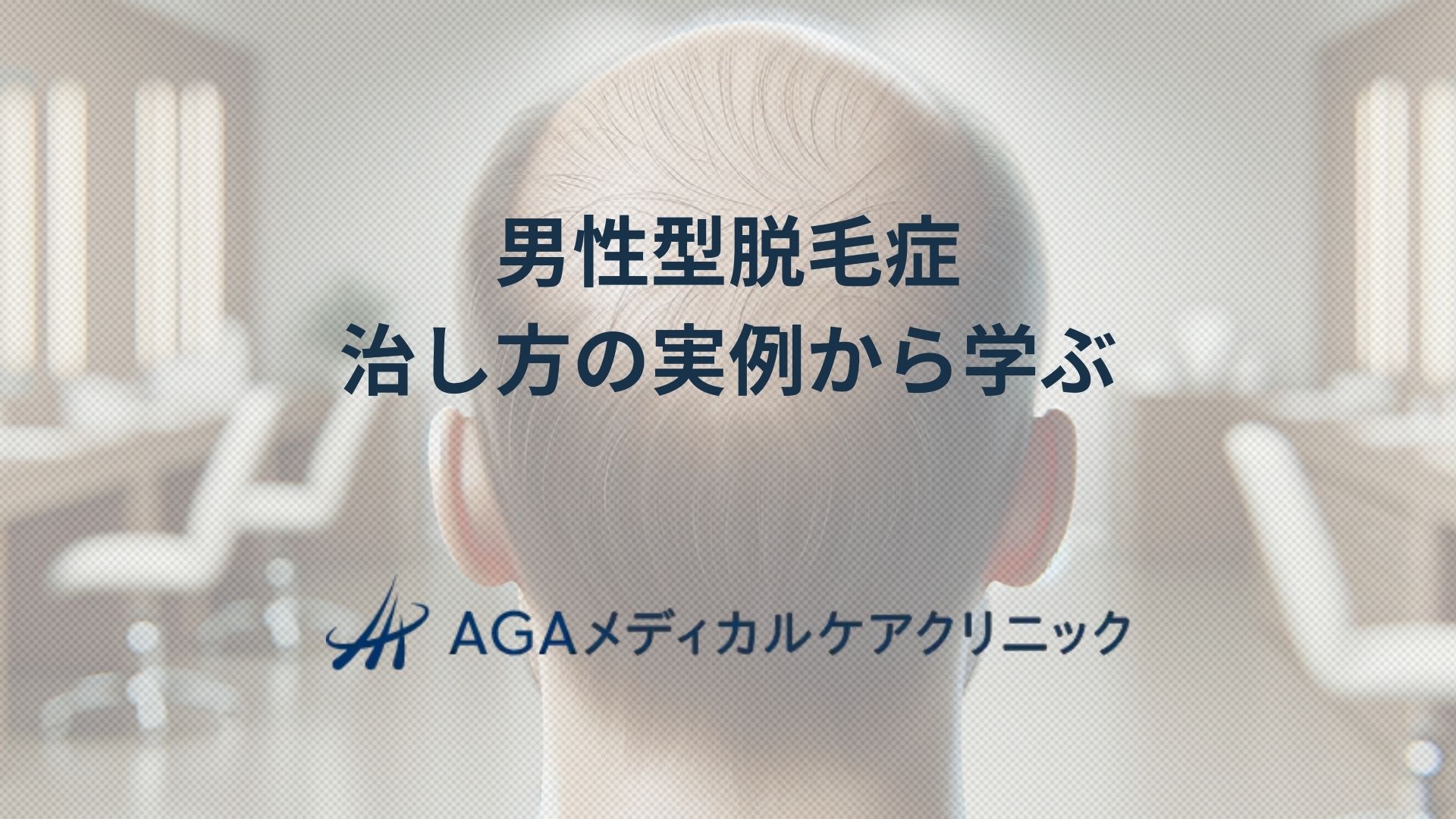 男性型脱毛症治し方の実例：皮膚科で行う薄毛治療と髪のケア