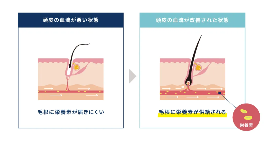 ミノキシジルの作用