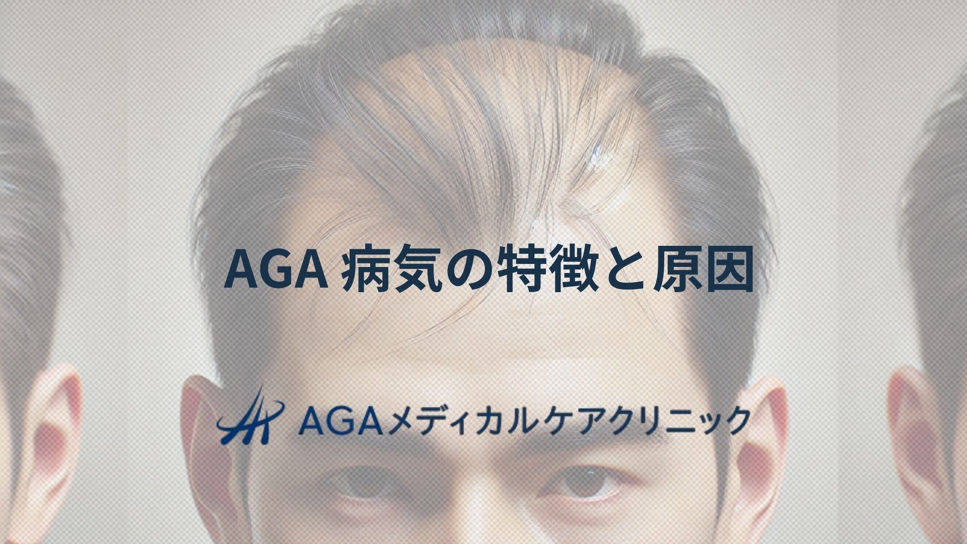 AGA 病気が進む原因とは─男性型脱毛症の特徴と治療の流れ