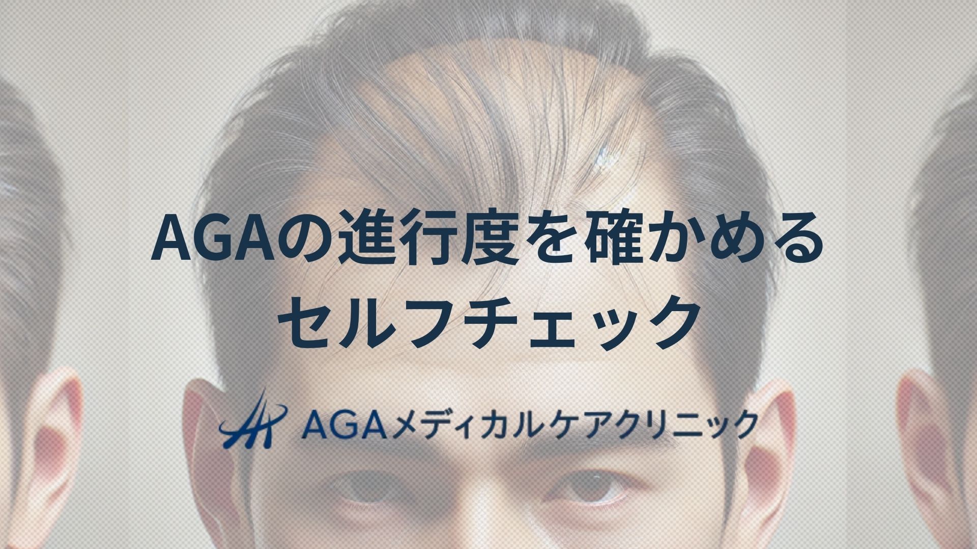 AGAセルフチェック 無料で薄毛の進行度を確かめる