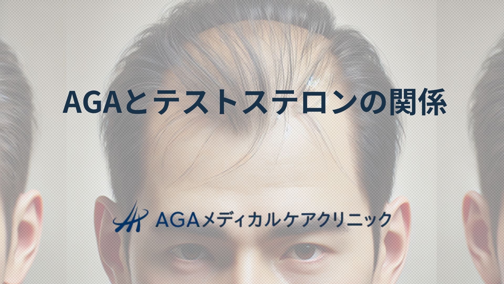 AGAとテストステロンはどう関係する？男性型脱毛症の原因と対処法