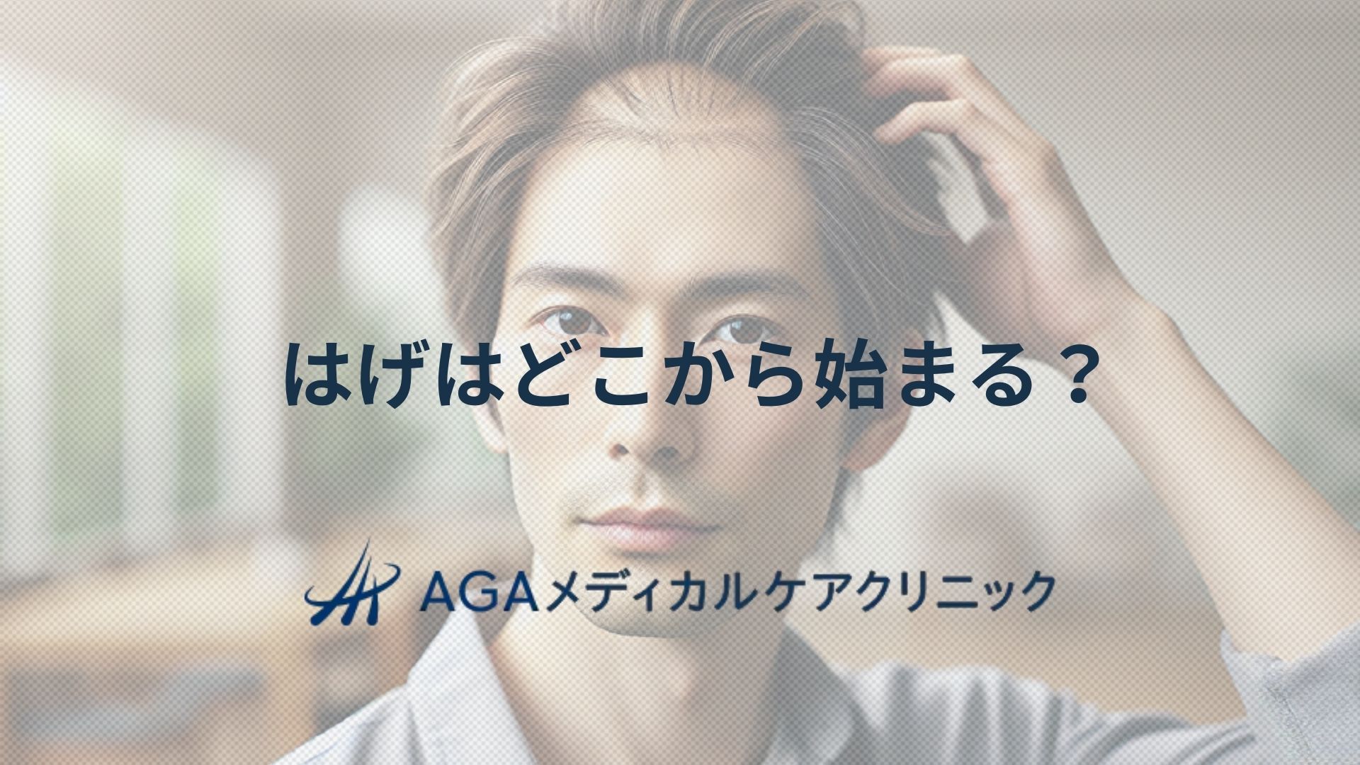 はげはどこから始まる?おでこやつむじの薄毛基準