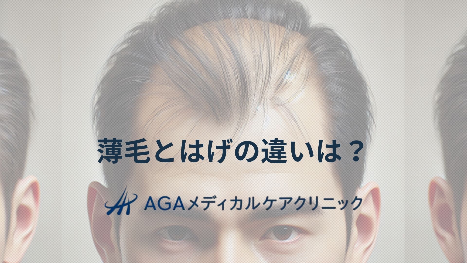 薄毛とはげの違いはどこにある?AGAを知って解決への第一歩