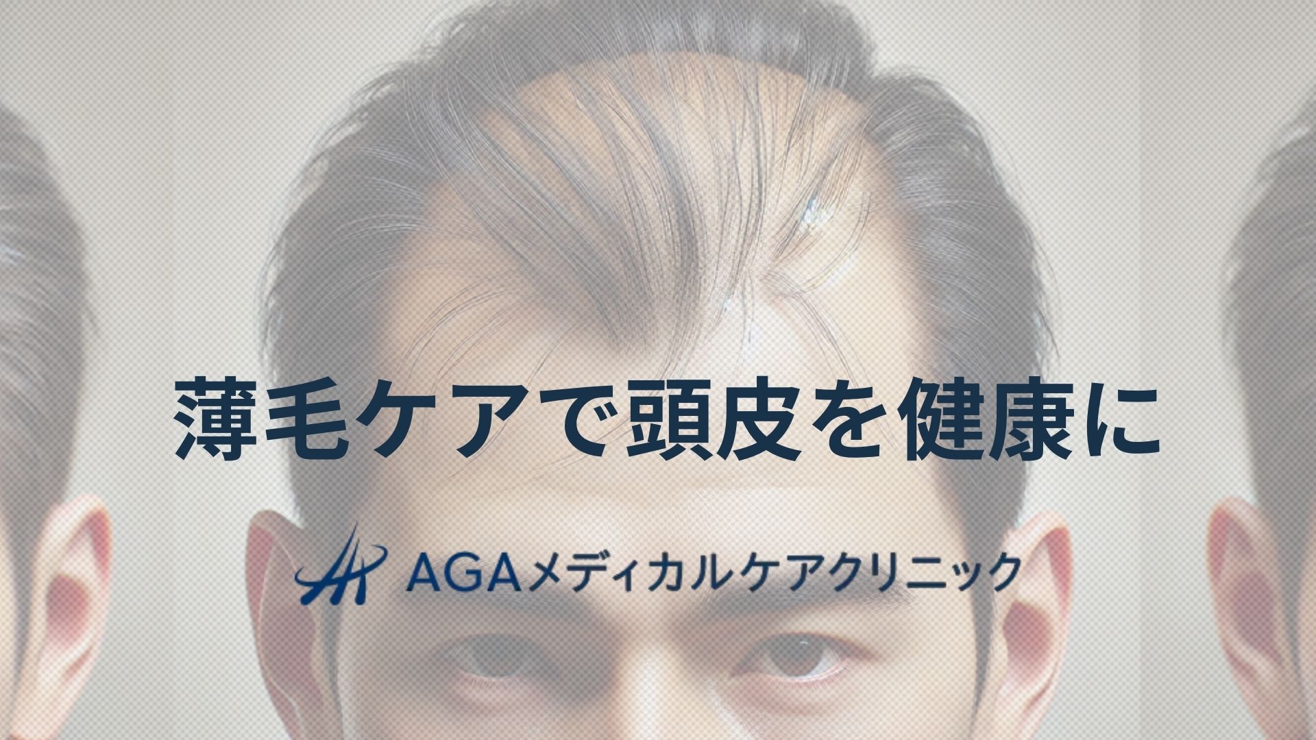 薄毛　ケア