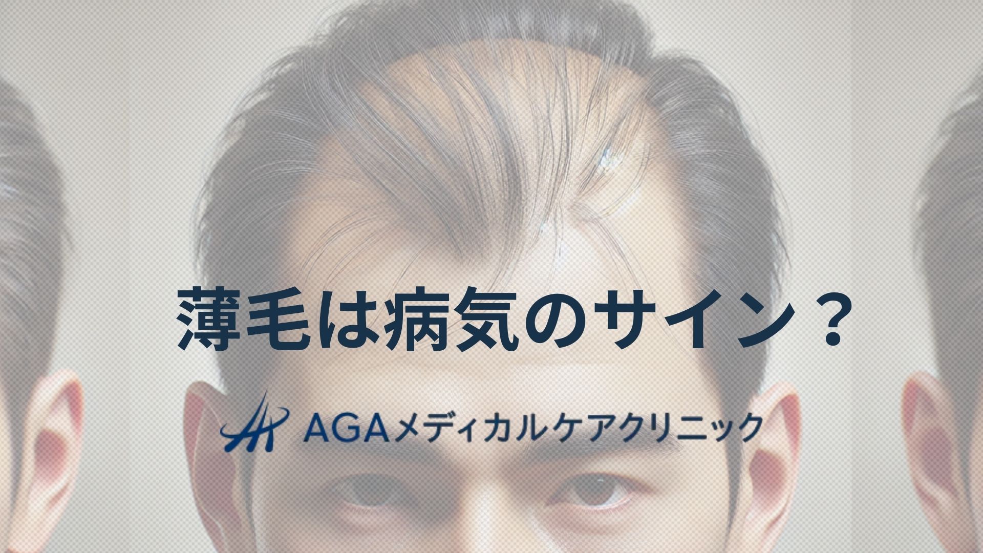 薄毛　病気
