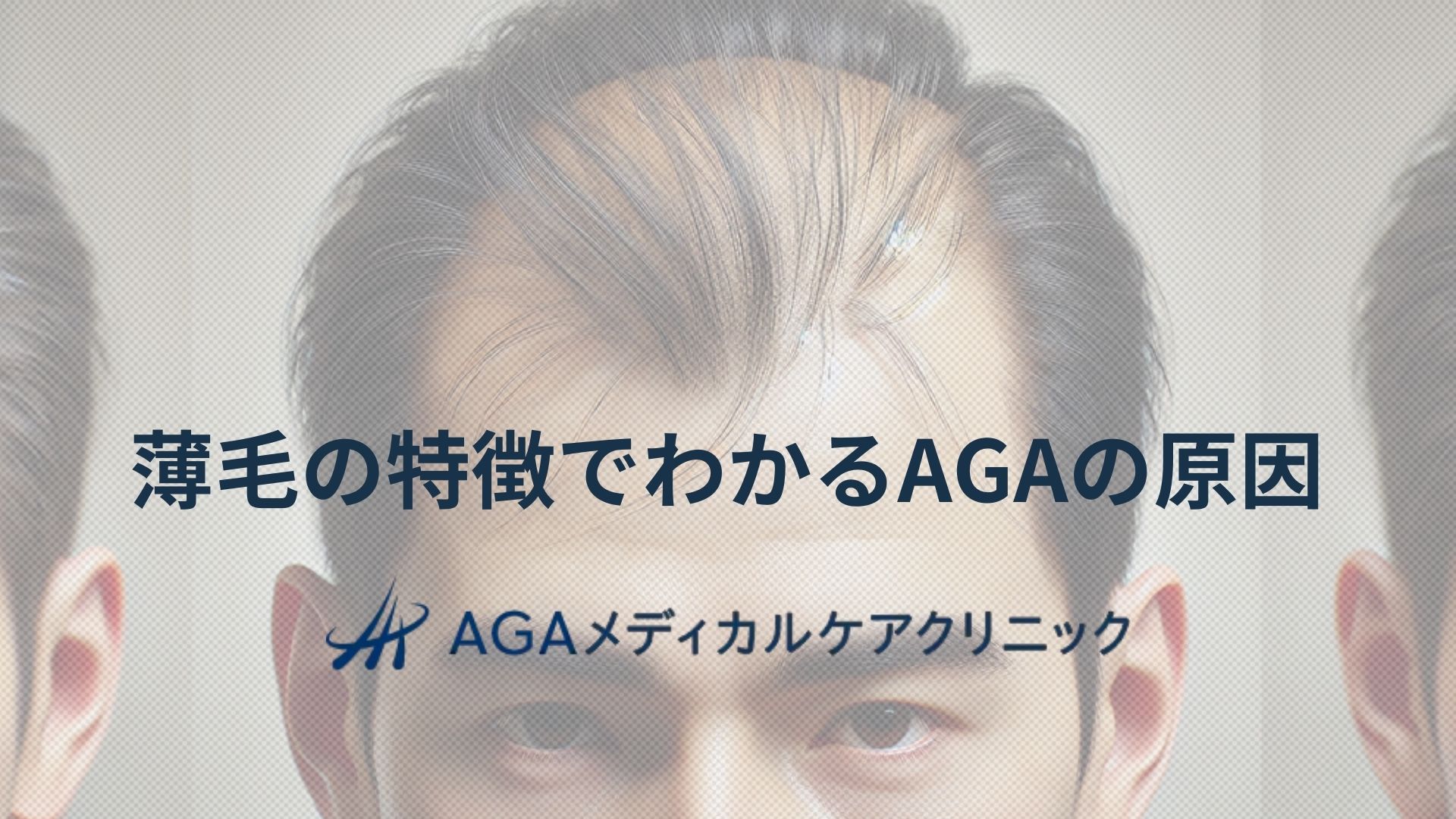薄毛の特徴でわかるAGAの原因と治療の基本を知ろう