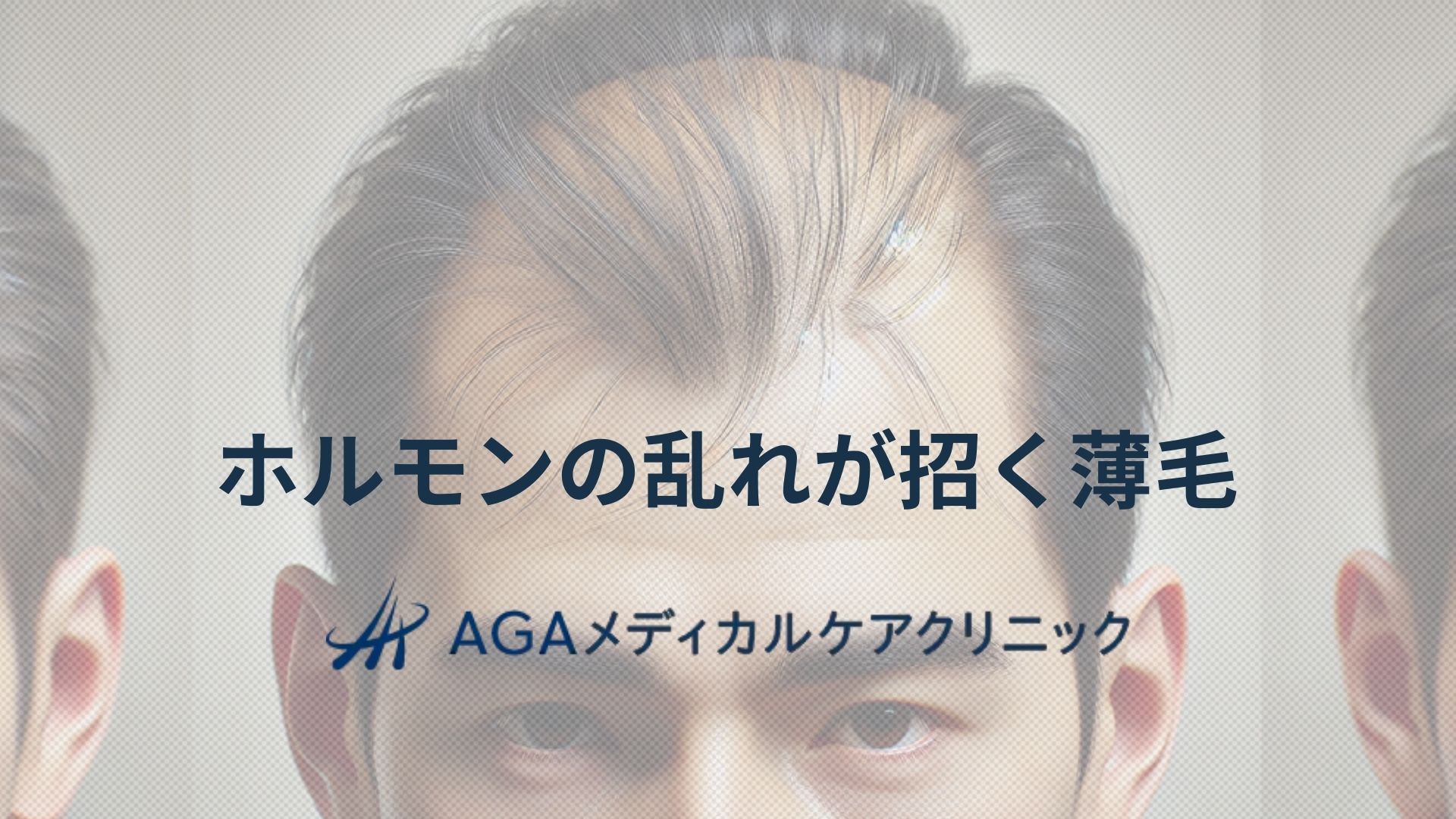ホルモンの乱れが招く薄毛と頭皮ケアの重要性