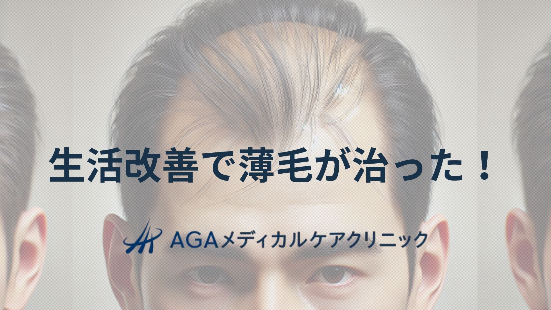 薄毛 生活改善 治った