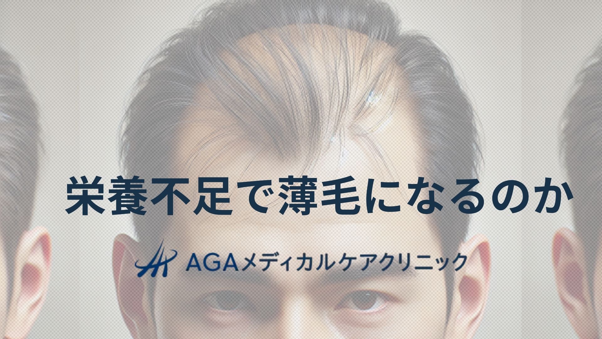 栄養不足は薄毛の原因になるのか AGA治療と日々の食事で考える髪の健康