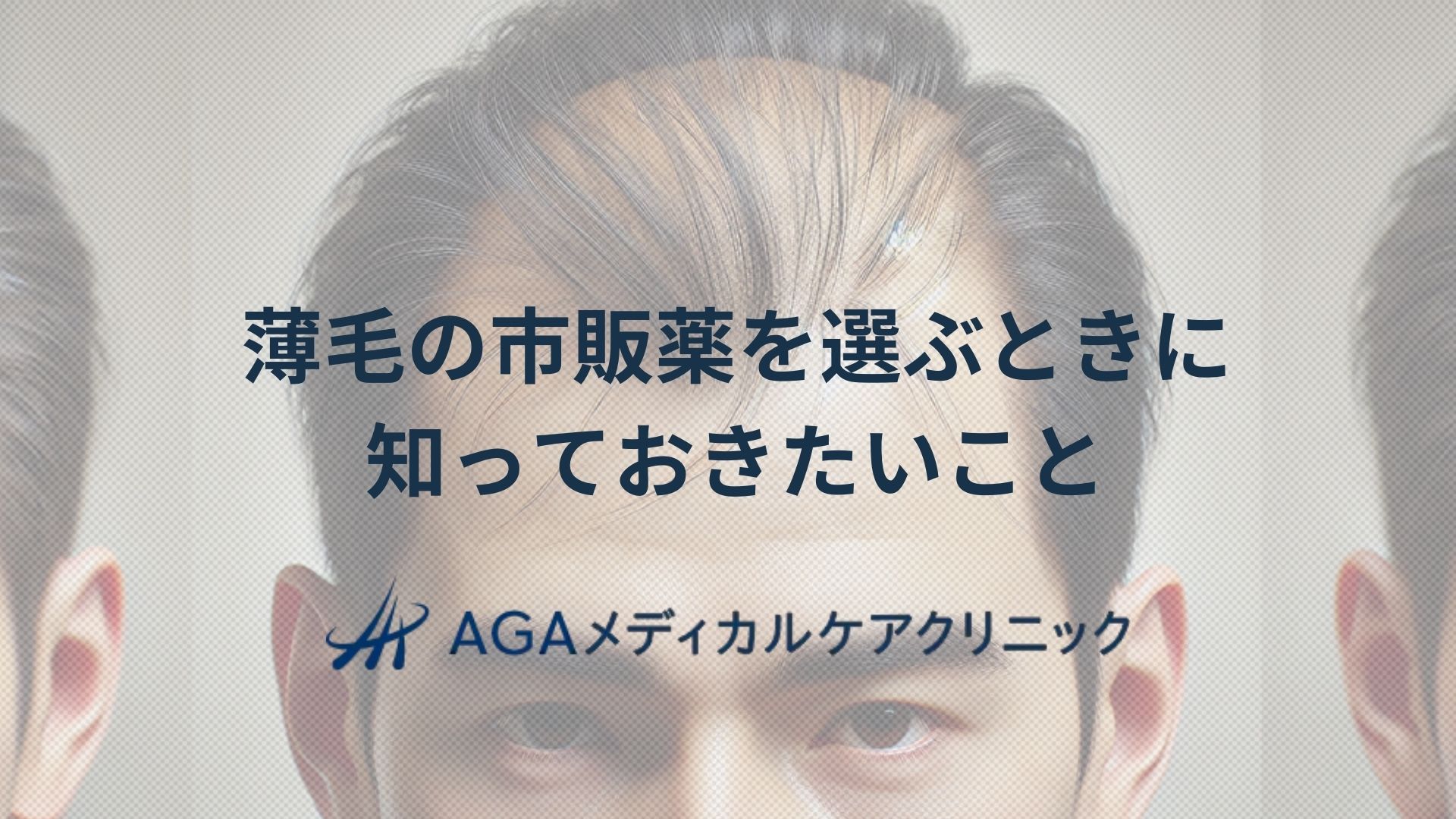 薄毛　薬　市販薬