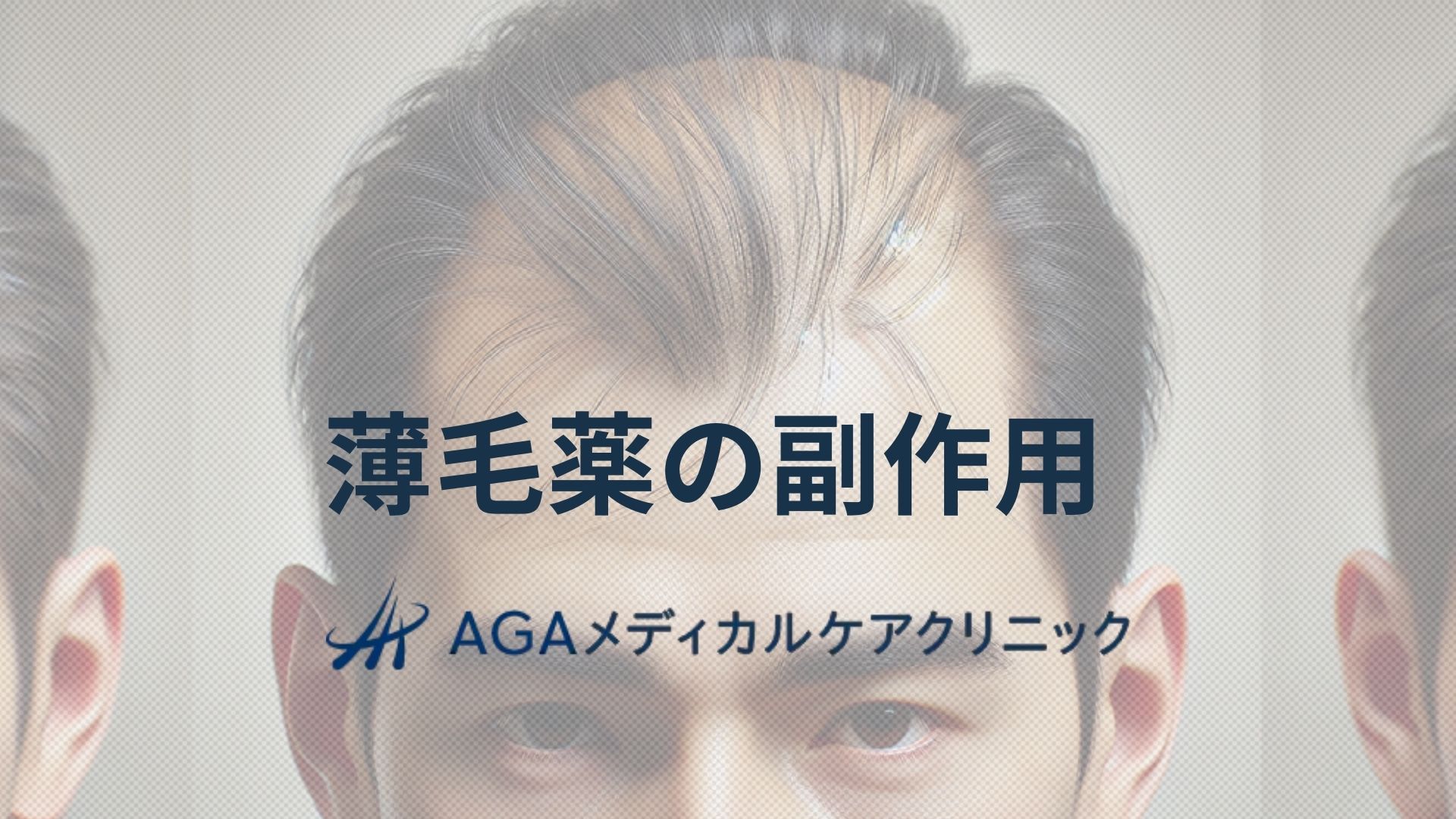 薄毛　薬　副作用