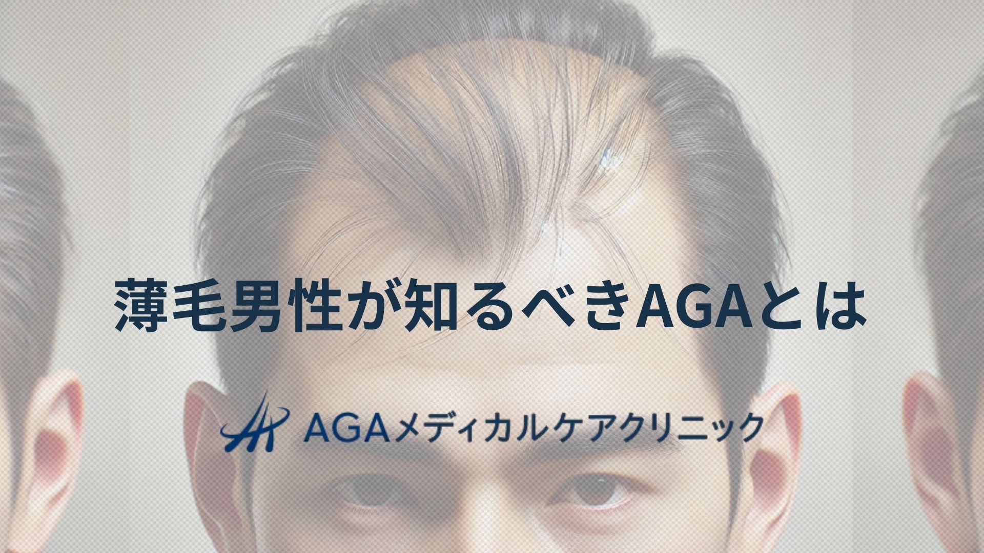 薄毛　男