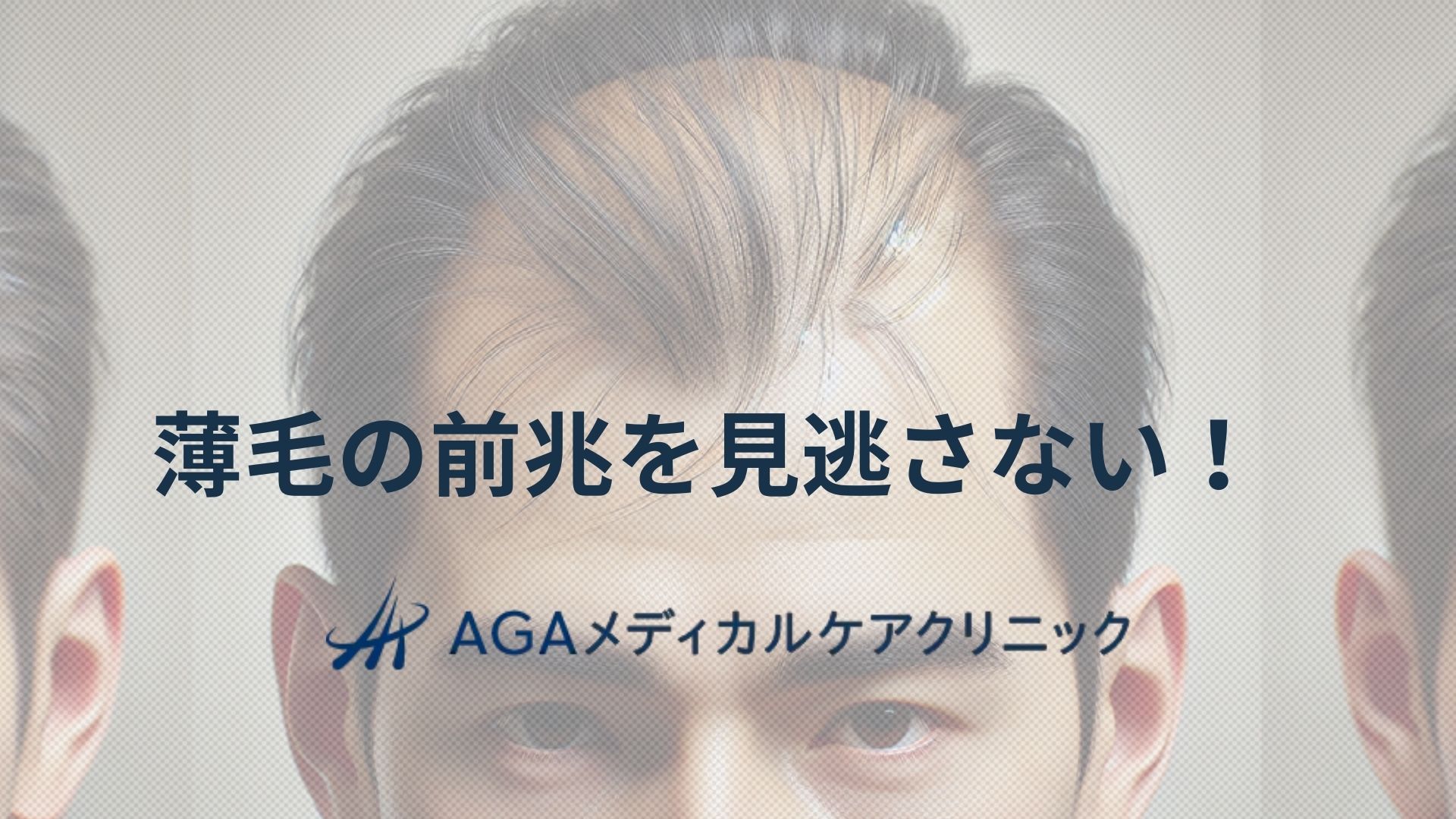 薄毛　前兆