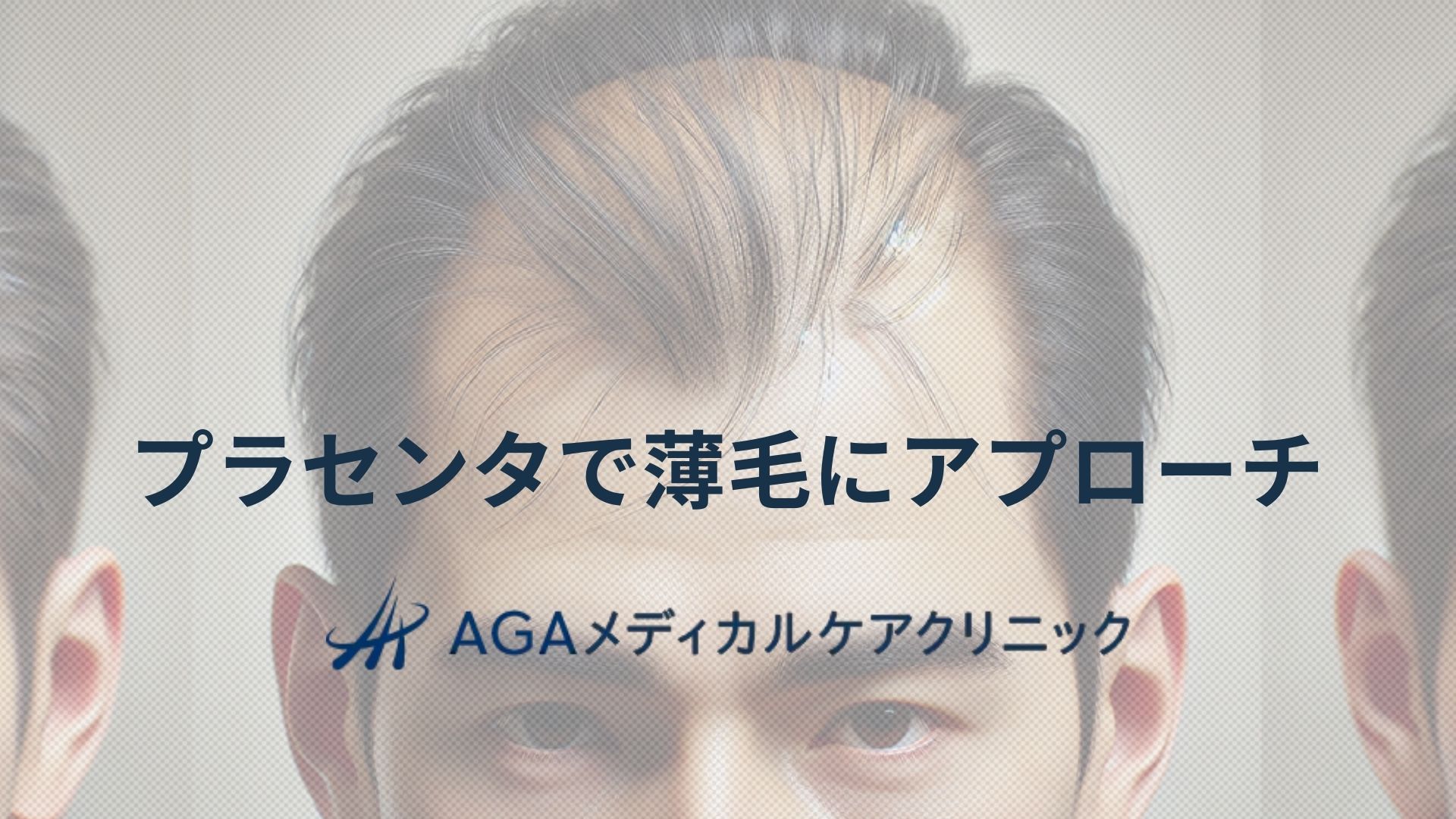 薄毛　プラセンタ