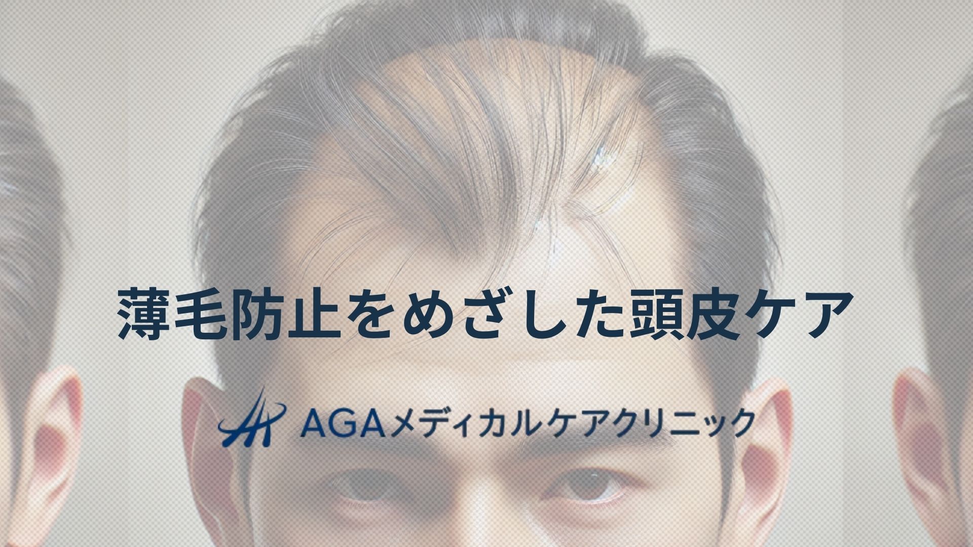 薄毛　防止