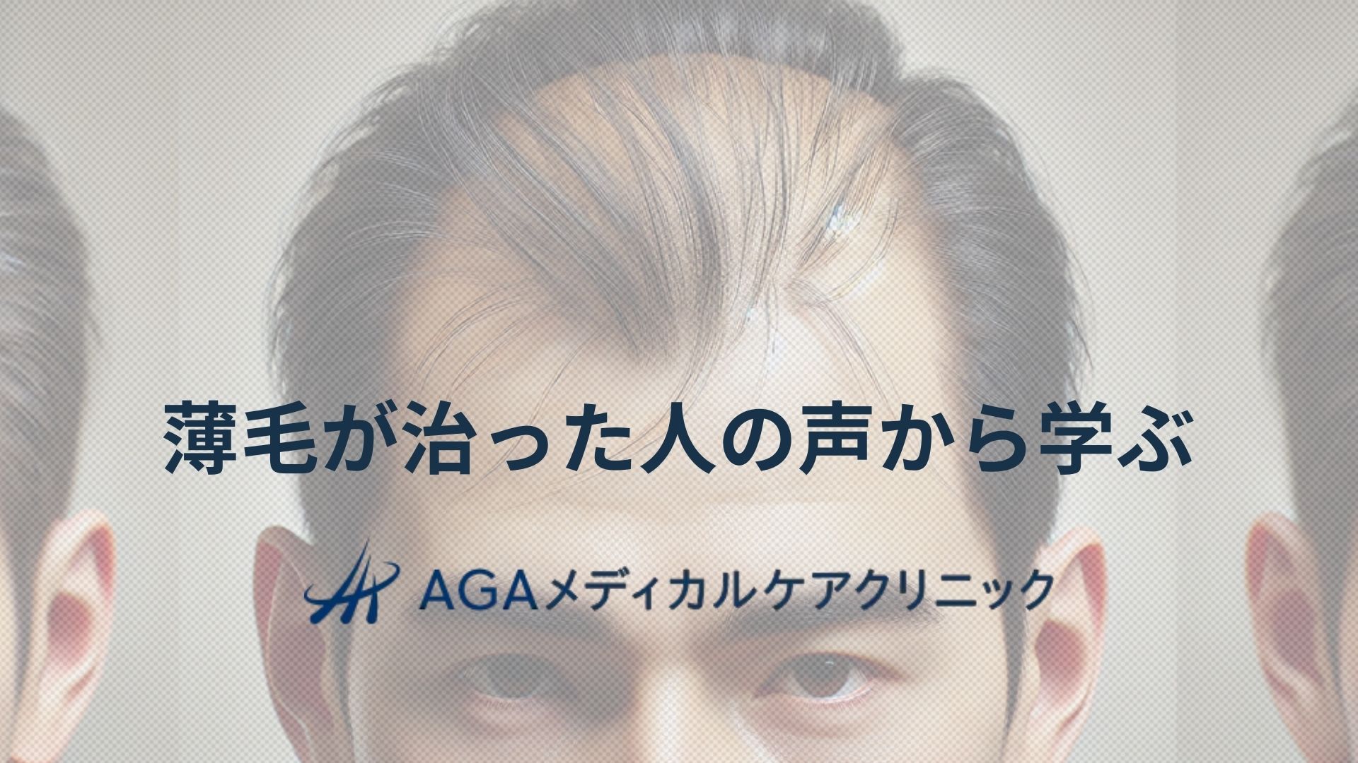 薄毛が治った人の声から学ぶAGA克服への近道