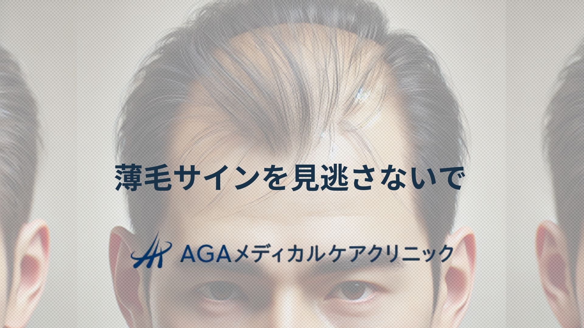 薄毛　サイン